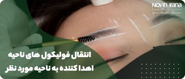 روش های کاشت ابرو